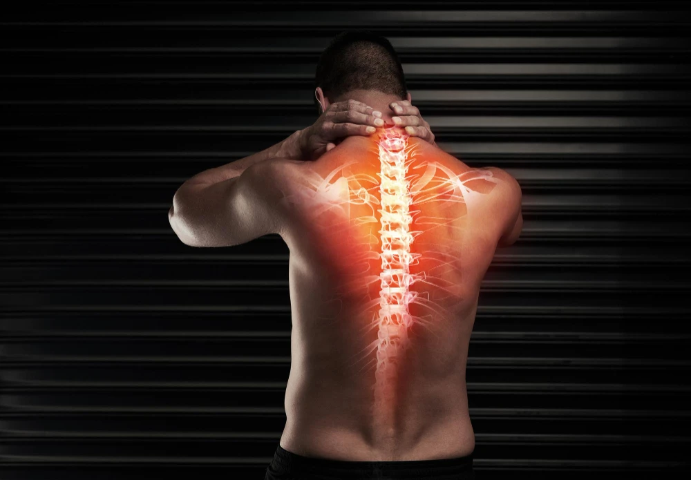 What Is a Typical Back Injury from a Car Accident?